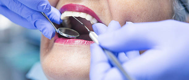 Best Emergency Dental Extractions in Mooresville, IN